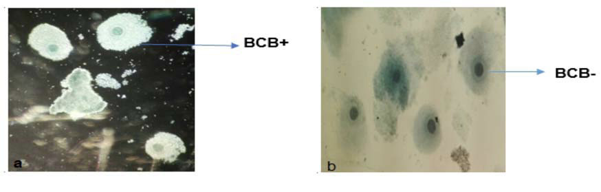 Complejos c�mulos-oocito (COCs) en bovinos (Bos indicus), te�idos con azul brillante de cresil. (a) BCB+ positiva a glucosa&ndash;6&ndash;fosfato deshidrogenasa. (b) BCB- negativa a glucosa&ndash;6&ndash;fosfato deshidrogenasa. Laboratorio de reproducci�n del Centro de Investigaci�n La Libertad, Corporaci�n Colombiana de Investigaci�n Agropecuaria (AGROSAVIA), Villavicencio, Meta, Colombia. 2017.