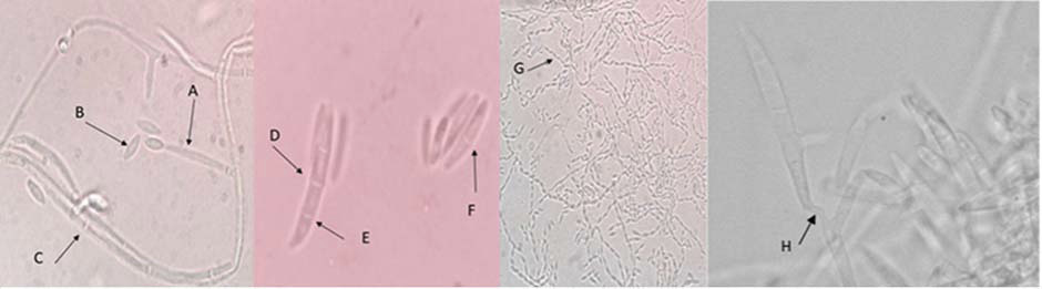 Estructuras morfol�gicas de F. verticillioides. A: Conidioforo; B: Microconidio unicelular; C: Micelio septado; D: Macroconidio en forma de canoa septado; E: Septo de macroconidio; F: Microconidios bicelulares G. Microconidios unicelulares en cadena larga; H: Fi�lides. Laboratorio de Fitopatolog�a, Campo Experimental Centro Altos de Jalisco (CECEAJAL), Instituto Nacional de Investigaciones Forestales, Agr�colas y Pecuarias (INIFAP). Tepatitl�n de Morelos, Jalisco. M�xico. 2019.