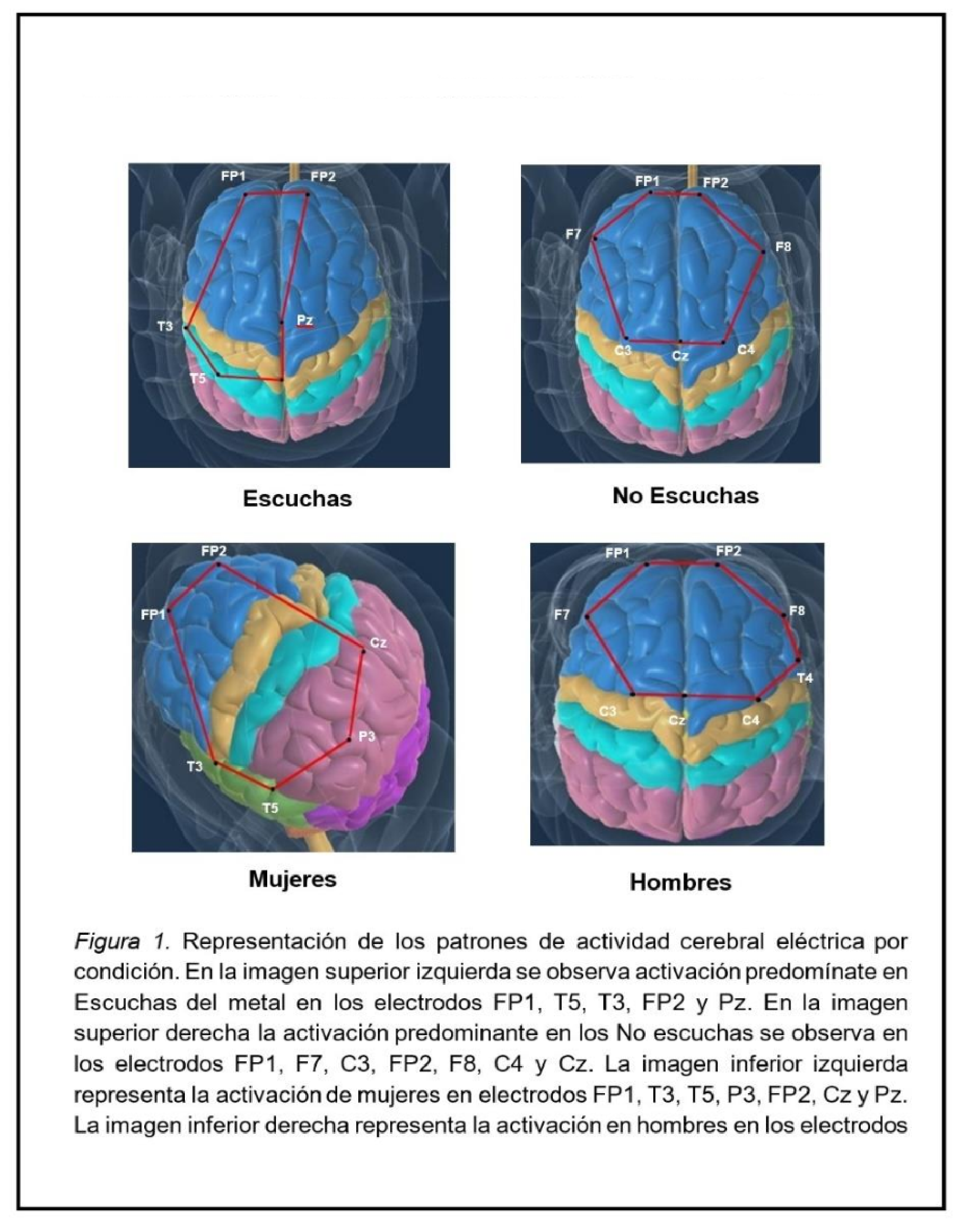 Figura 1. Patrones de actividad electrica cerebral por condicion.