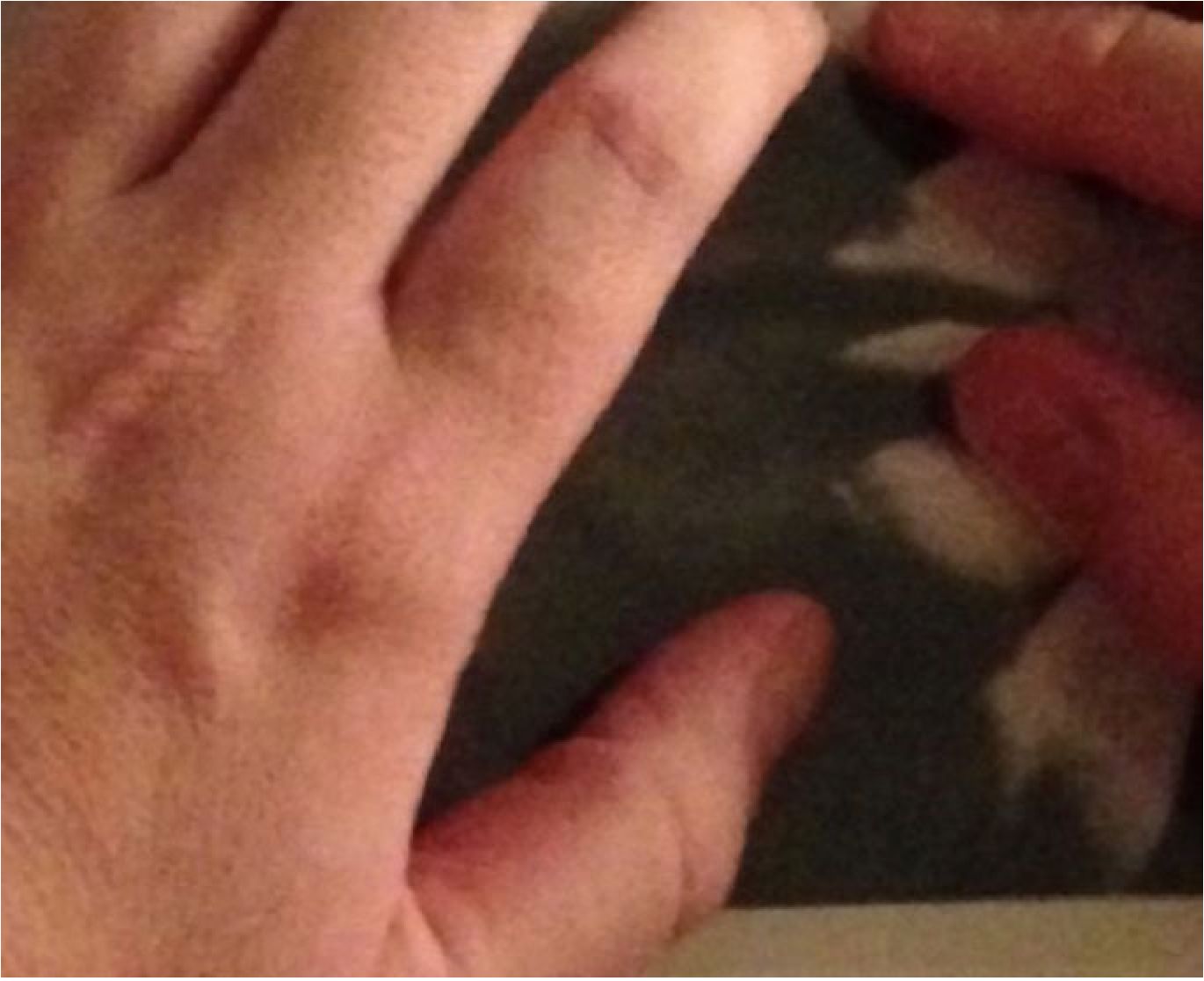 Mis manos tocan la piel de la foto.