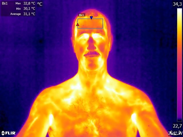 Termografia de um homem adulto saudável sentado em uma confortável temperatura ambiente de 24°C. Os valores máximos, mínimos e médios mostrados no canto superior esquerdo correspondem à área retangular na testa, onde normalmente são feitas as medições