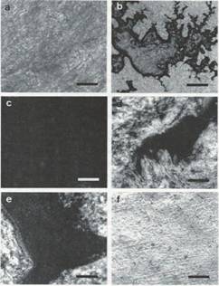 Microfotograf&iacute;as de pel&iacute;culas obtenidas de los componentes y las mezclas entre los nylons 6 y 11 y la poliesteramidaP6STE10A90: a) Nylon 6; b) M61050; c) P6STE10A90; d) M111025; e) M111050; e) Nylon 11. Barra de escala equivalente a 250 (m