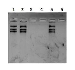 Electroforesis en gel de Agarosa del ADN plasm&iacute;dico pcDNA3.1 Zeo(+) Venus-1 Zipper. L&iacute;nea 1 representa el ADN obtenido por precipitaci&oacute;n etan&oacute;lica, L&iacute;nea 2: Columna de QIAprep&reg; y L&iacute;nea 3 a 6: muestras de nanopart&iacute;culas de Fe3O4@SiO2 T1, T2, T3 y T4