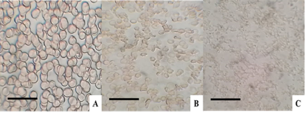Hemolysis assay in 5 % blood cells concentrate. In (A) normocytic blood cells, in (B) hemolysis with 5 min, and (C) hemolysis with 10 min. Bars: (A) 150 µm, (B) 100 µm and (C) 100 µm. Source: authors, 2020