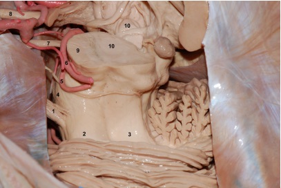 Vista superolateral del tronco cerebral y cerebelo.