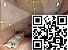 Escanea el c&oacute;digo QR para reproducir el Video