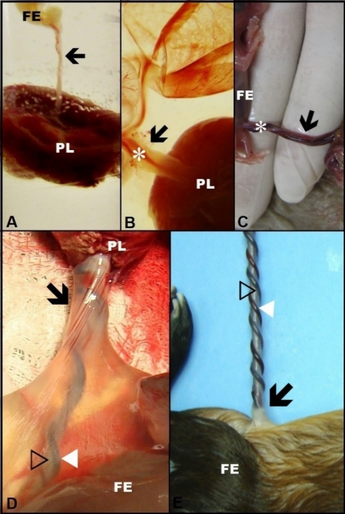 Photographs of the umbilical cord of agouti (D.
Prymnolopha) at different gestational ages,
expressed in postcoital days (dpc). A: Umbilical cord (black arrow) joining
the placenta (PL) to the foetus (FE) at 30 dpc. B: Blood vessels (asterisk) beginning
the spiral process of the umbilical cord (black arrow) near the placenta (PL)
at 35 dpc. C:
Fully spiral vessels (asterisk) of the umbilical cord (black arrow) near the
foetus (FE) at 50 dpc. D: Arteries (hollowed arrow) located centrally to the umbilical
cord (black arrow) and veins (white arrow) spiralling the cord connecting the
placenta (PL) to the foetus (FE) at 75 dpc. E: Veins
(white arrow) enveloped the arteries (hollowed arrow) of the umbilical cord
(black arrow) attached to the foetus (FE) at 100 dpc.