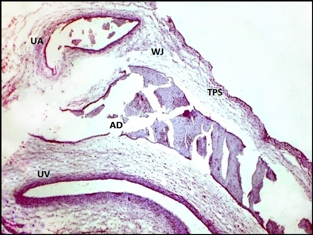Photomicrography of the umbilical cord of
agouti (D. Prymnolopha) 35 days postcoital in
longitudinal section. The umbilical cord is delimited by simple pavement
epithelial tissue (TPS), adhered to the mucous connective tissue or Wharton's
jelly (JW) and the presence of vessels: an artery (UA), an umbilical vein (UV) and
allantoic duct (AD). H&E: 4x.