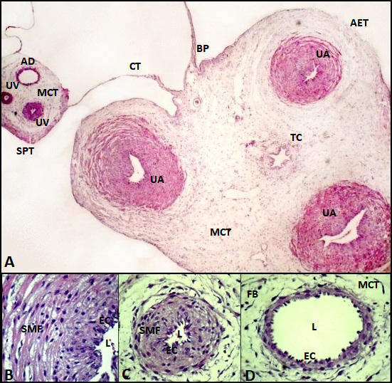 Photomicrography of cutia umbilical cord (D. Prymnolopha)
50 days after intercourse. A:
Umbilical cord divided in two parts, joined by filaments of simple pavement
epithelial tissue, attached to the connective tissue (CT), mucous connective
tissue mass (MCT), covered by amniotic epithelial tissue (AET), three large
umbilical arterial vessels (UA) and branching point (BP) for small vessel
formation: two umbilical veins (UV) and one allantoic
duct (AD) adhered to a small mass of connective tissue (CT) surrounded by
simple pavement epithelial tissue (SPT). H&E: 4x. B: Umbilical artery with three layers: the outermost, the middle,
formed by smooth muscle fibres (SMF), and internal (adventitia), by endothelial
cells (EC) around the lumen (L). H&E: 100x. C: Umbilical vein with two layers: the external one formed of
longitudinal smooth muscle fibres (SMF) and the internal one by endothelial
cells (EC) near the lumen (L). H&E: 40x. D: Allantoic duct adhered to mucosal
connective tissue (MCT) with a large number of fibroblasts (FB), formed only by
a simple layer of epithelial tissue with endothelial cells (EC), flat cells
with central nuclei and ovals in contact with the lumen (L). H&E: 40x.