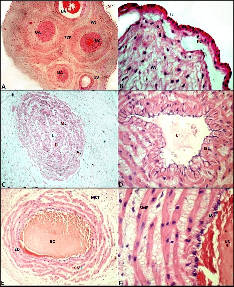 Photomicrography of the wall of the umbilical
cord of the cutia (D. Prymnolopha)
100 days post coitus. A: Shows
simple pavement epithelial tissue (SPT), Wharton jelly (WJ) with elastic and
collagen fibres (ECF), arteries (UA) and umbilical veins (UV). H&E: 4x. B: Simple layered epithelial tissue
layer (TL), pavement cells (PC); Wharton jelly (WJ) rich in an amorphous
substance synthesized by fibroblasts (FB). H&E: 100x. C: Umbilical artery: adventitious layer (AL), with longitudinal and
circular muscle fibres, the middle layer (ML), with longitudinal muscle fibres,
intima layer (IL) and arterial lumen (L). HE: 10x. D: Umbilical artery: irregularly shaped arterial lumen (L),
internal elastic lamina (IEL). H&E: 40x. E: Umbilical vein: circular smooth muscle fibres (SMF), endothelium
(ED), blood clot lumen (BC), mucosal connective tissue (MCT). H&E: 10x. F: Umbilical vein: Myofibrils, smooth
muscle fibres (SMF) with longitudinal arrangement and second layer with
endothelial cells (EC), blood clot lumen (BC). H&E: 40x.