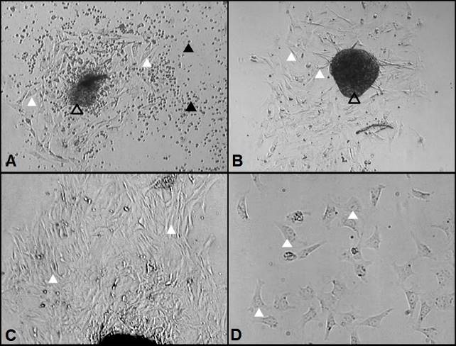 Cultures of cutia
umbilical cord explant (D. prymnolopha, Wagler, 1831). A: Spindle cells (white arrows) around a
fragment of umbilical cord (hollowed arrow), in the first passage. Numerous
mononuclear cells with round or oval morphology in suspension (black arrows)
are identified. Magnification: 5x. B and C: Spindle cells (white arrows)
distributed marginally to explant (arrow cast), in the fifth passage.
Magnification: 10x. D: Homogeneous colony of fusiform cells with evident nuclei
(white arrows), nucleoli and cell boundaries, in sixth passage. Magnification
20x.