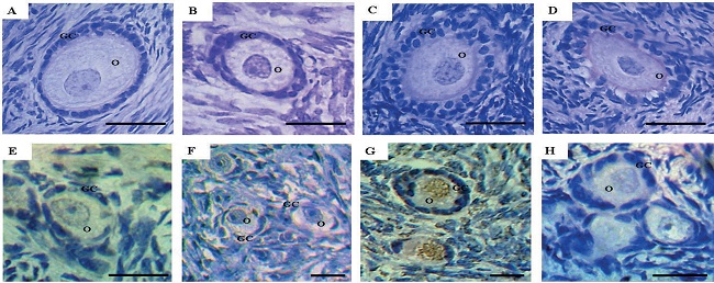 Histological sections and TUNEL positive cell detection in
									ovine ovarian tissue after in vitro
									preservation. Normal primary follicle in the fresh control (A),
									normal intermediate follicle after 6 h of preservation in MEM
									(B), normal secondary follicle after 24 h of preservation in 0.2
									mg/mL A. cearensis extract (C), atretic
									intermediate follicle after 24 h of preservation in 0.1 mg/mL
										A. cearensis extract (D), normal primordial
									follicle after preservation for 6 h in MEM (E) and for 24 h in
									0.2 mg/mL A. cearensis extract (F); follicle
									preserved in 0.4 mg/mL A. cearensis extract for
									24 h, showing DNA fragmentation in brown (G) and negative
									control (H). O: oocyte; GC: granulosa cells. Scale bar: 30
									&micro;m (400x).
