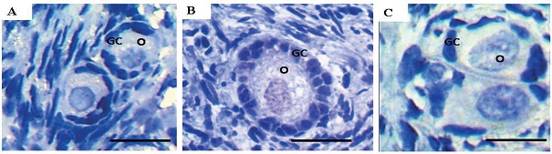 DNA fragmentation detection in ovine ovarian tissue cultured
										in vitro for 7 days. Normal ovarian
									follicles after culture in Amb 0.1 mg/mL (A); Apoptotic follicle
									cultured in α-MEM+ (B) and negative control (C). Note the
									DNA damage in the oocyte and granulosa cells (brown) in figure
									B. O: oocyte; GC: granulosa cells. Scale bar: 25 &micro;m
									(400x).