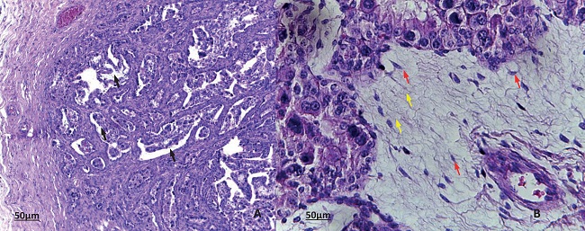 Histological sections of bovine placenta stained with H&E. Normal
						tissue pattern in which villi can be observed A. 10x. Black arrows. B. 40x -
						Observe the areas of edema in the chorion laeve (yellow arrows) and the
						presence of mesenchymal cells (red arrows).
