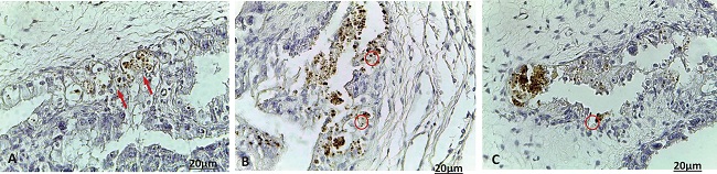 Histological sections of bovine placenta labeled through
						immunohistochemistry. A. 40x. B. and C. 40x - Observe the labeling of
							Neospora caninum tachyzoites (arrows), aggregates of
						tachyzoites of the parasite labeled through the
						streptavidin-biotin-peroxidase immunohistochemical technique (reddish
						circle).