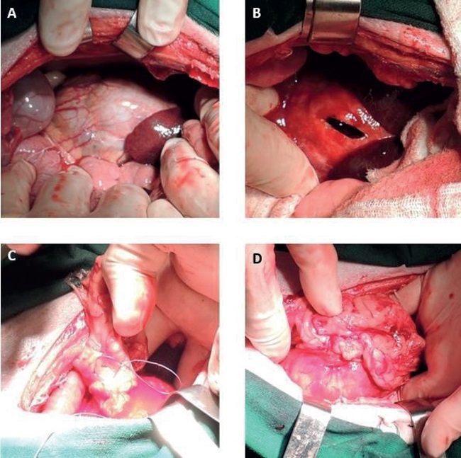 (A) Distended renal capsule due to perinephric abscess in a dog. (B)
							Aspect of the capsule after drainage using a syringe and needle,
							followed by capsulotomy. (C) Omentum flap positioned over the renal
							surface. (D) Omentopexy completed.