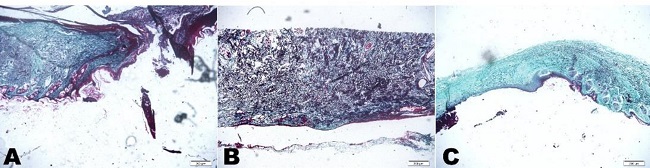 Photomicrography of collagen percentage on open skin wounds from
							rabbits treated with 2 mg ml-1T. aestivum aqueous extract (T2- A), 10 mg
								ml-1T. aestivum aqueous extract (T10 B) and non-ionic cream
							(CT- C), at 7 days. Figure demonstrated that treated wounds with T2 and
							TC presented presence of collagen (blue coloration), while in the T10
							treated wound do not have the protein.