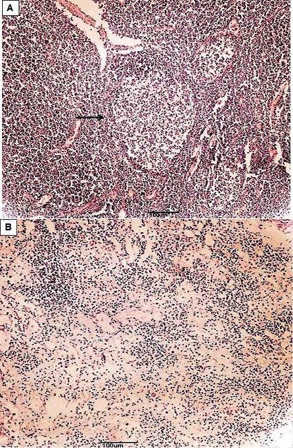 (A) Normal lymph node of Sotalia guianensis.
								Observe lymph node (→) activated. (B) Sotalia
									guianensis lymph node with marked lymphoid depletion.
								Observe parenchyma presenting spaces not filled by lymphoid cells.
								Bar: 100µm, HE.