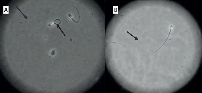 Spermatozoa reactive (A), and non-reactive (B), to the hypoosmotic
							test.