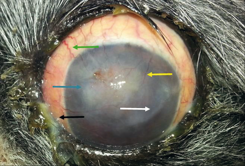 Eye of a dog with glaucoma secondary to uveitis, showing engorged
							episcleral vessels (green arrow), corneal neovascularization (yellow
							arrow), fracture of Descemet’s membrane (white arrow), diffuse corneal
							edema (blue arrow), and purulent secretion (black arrow).