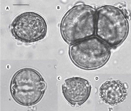 The most frequent pollen species: (A) Anthurium  Type 1; (B) Ericaceae Type; (C) Malpighiaceae Type 2; (D) Peperomia;  (E) Solanaceae Type 1. The bar at the upper right side measures ten micrometers.