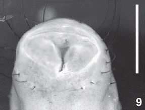   Passalus (Pertinax) gravelyi.   Anal ring, ventral view. Scale bar, = 1.0 mm.