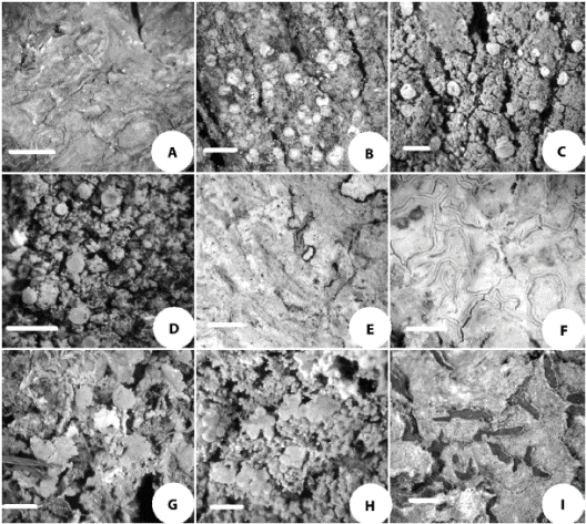 New lichens records for Colombia. (A) Anthracothecium prasinum (Eschw.) R. C. Harris. (B) Arthonia aff. cinnabarina. (C) Calopadia editae Vezda ex Chaves & L&uuml;cking. (D) Coenogonium pineti (Ach.) L&uuml;cking & Lumbsch. (E) Graphis ferruginea Vain. (F) Graphis glaucescens F&eacute;e. (G) Phyllopsora labriformis Timdal. (H) P. chlorophaea (M&uuml;ll. Arg.) Zahlbr. (I) Thecaria montagnei (Bosch) Staiger. White bar= 1mm.