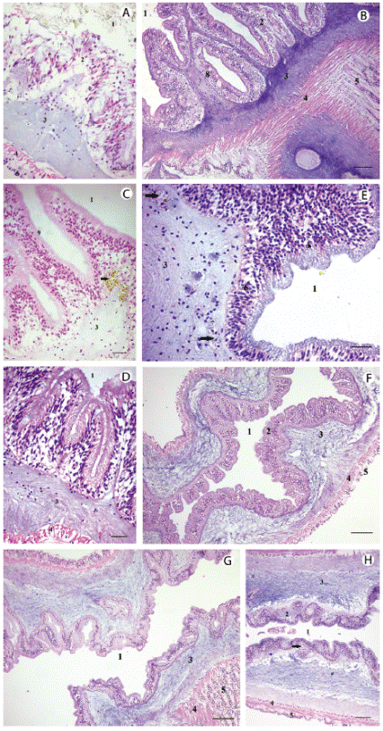 Cortes histológicos del estómago, del intestino anterior, medio y posterior de Isostichopus  sp. A. Estómago. H-E. B. Epitelio intestinal cilíndrico con núcleo basal, vellosidades largas, tejido conjuntivo denso subepitelial y amplia banda densa, condroide, que se apoya en dos delgadas capas de músculo liso, circular y longitudinal. H-E. C. Intestino medio con epitelio luminal y una célula epitelial grande y vacuolada que contiene gránulos café en su citoplasma (*). H-E.D. Intestino medio con epitelio luminal, con células mucosas, enterocitos, una extensa capa de tejido colágeno, rodeado por musculatura lisa y circular y el plexo neural. H-E. E. Intestino posterior: Epitelio intestinal cilíndrico con núcleo basal, vellosidades poco aparentes, tejido conjuntivo denso subepitelial y amplia banda densa, condroide. H-E. F. Intestino posterior de I. badionotus; G. Intestino posterior de S. sp; H. Intestino posterior de S. hermanni. Se aprecia de adentro hacia afuera del TD: el epitelio intestinal, el tejido conjuntivo y el plexo neural. H-E. I. Corte longitudinal del intestino posterior de I. badionotus  que muestra un epitelio intestinal cilíndrico que se apoya sobre una lámina basal con células mononucleares. A la derecha, tejido conjuntivo denso con un cuerpo lamelar ovoide, tipo psamoma. H-E. 1: Lumen digestivo; 2: Epitelio glandular (secreción mucoprotéica); 3: Tejido conectivo; 4: Músculo circular; 5: Epitelio exterior o celómico; 6: Epitelio cilíndrico; 7: Gránulos densos; 8: Células mucosas; 9: Microvellosidades; 10: Células café; 11: Cuerpos de psamoma. Escala: 10 mm.