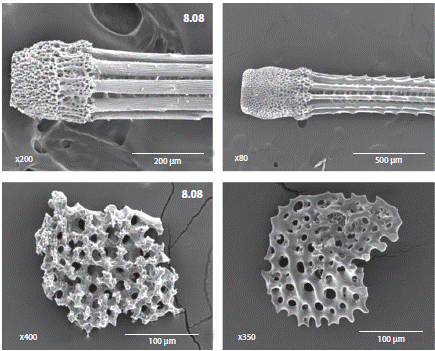 Comparison of structures between a juvenile and an adult of Astropyga pulvinata. Left side, juvenile specimen (ICML-UNAM 4.8.8), right side, adult specimen. Shape of the base of primary spines (up); ossicles from the peristome (below).