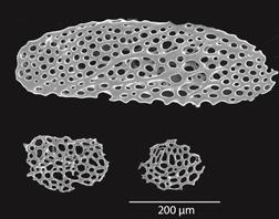 Astropyga pulvinata, ossicles from the anal membrane.