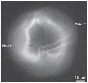 Ventral views of Lingulodinium polyedrum from Manzanillo. Light microscopy stained with calcofluor white.