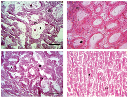 Sustancias reactivas de la tinci&oacute;n PAS-Shiff. Se se&ntilde;alan los aden&oacute;meros de la gl&aacute;ndula digestiva con un 15 %-40X (A), 20 % -10X (B), 26 %-40X (C) y 32 %-10X (D) de &iacute;ndice gl&uacute;cido. pa: pared del acino, s: c&eacute;lulas digestivas, dp: ducto primario, ds: ducto secundario, l: lumen del acino. Barra: 50 μm (40X) y 100 μm (10X).
