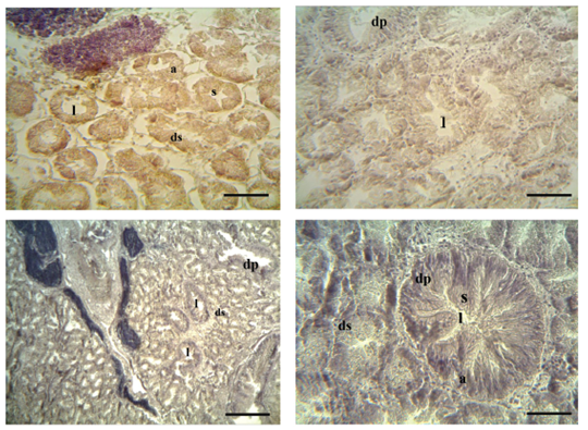 Sustancias reactivas de la tinci&oacute;n Sud&aacute;n Negro B. Se se&ntilde;alan los aden&oacute;meros de la gl&aacute;ndula digestiva con un 17 % (A), 23 % (B), 27 % (C) y 34 % (D) de &iacute;ndice gl&uacute;cido. pa: pared del acino, s: c&eacute;lulas digestivas, dp: ducto primario, ds: ducto secundario, l: lumen del acino. Barra: 50 μm.