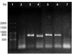 Products of mcyB gene amplification of cyanobacterial strains isolated from water and tissue of reef organisms of the Brazilian Northeast coast. Lines:1 - 100bp ladder, 2 - Synechocystis aquatilis M3C (mcyB not detected), 3 - Romeria gracilis M6C, 4 - Synechocystis aquatilis M20C, 5 - Synechococcus nidulans M38C, 6 - Synechococcus nidulans M41C, 7 - Negative control. Positive samples: 3, 4, 5 and 6 (PCR product of mcyB gene ~ 800pb).