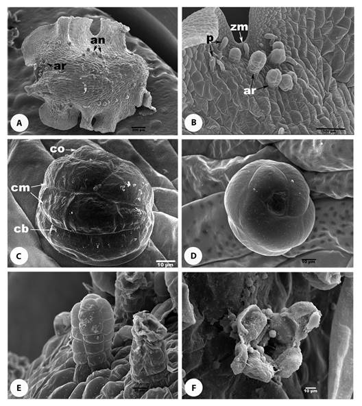 Gametangia of the Gleicheniaceae. (A) Mature gametophyte of Gleichenella pectinata. (B) Close up of the meristematic zone of a gametophyte of G. pectinata. (C) Antheridium of Diplopterygium bancroftii. (D) Antheridium of Sticherus bifidus (E) Arquegonium necks of D. bancroftii. (F) Open neck of an Arquegonium of S. palmatus. an= antheridium, ar= archaegonium, cb= basal cell, cm= medial cell, co= opercular cell, p= hairs, zm= meristematic zone.