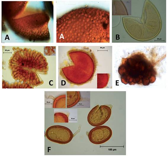 Esporas de los nuevos registros de hongos micorriz&oacute;genos arbusculares. A. Acaulospora foveata, Janos & Trappe; B. Acaulospora rehmii Sieverd. & S. Toro; C. Sclerocystis taiwanensisC.G. Wu & Z.C. Chen; D.Glomus tortuosum N.C. Schenck & G.S. Sm.; E. C&eacute;lulas auxiliares del g&eacute;nero Scutellospora; F.Glomus trufemiiB.T. Goto, G.A. Silva & Oehl. 
