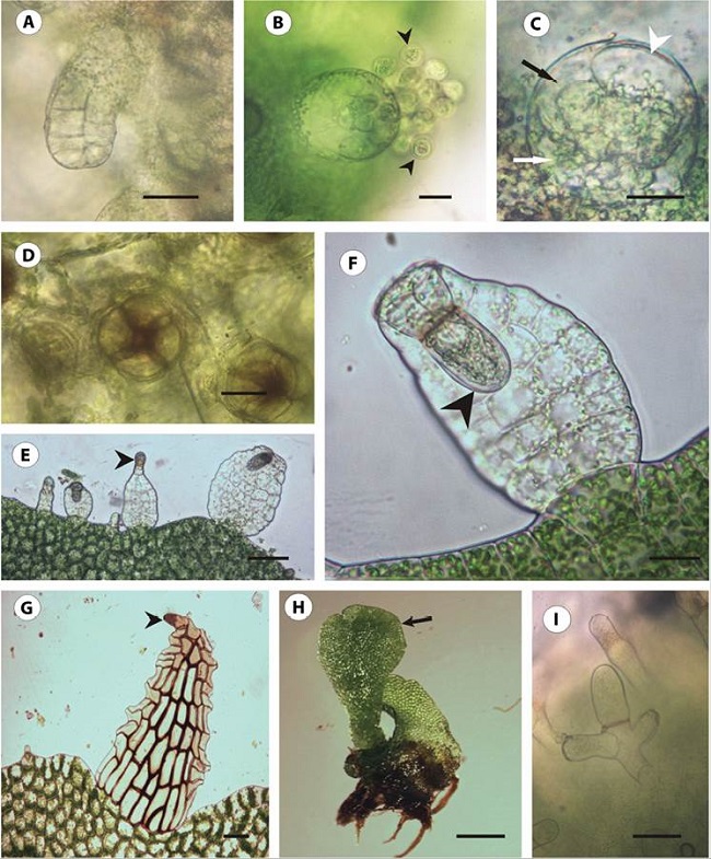 Gametangios y esporofito de P. macrocarpa. (A) Arquegonio con el cuello curvo. (B) Anteridio con anterozoides (cabeza de flecha). (C) Anteridio compuesto por una célula basal (flecha blanca), una célula anular (flecha negra) y el opérculo (cabeza de flecha). (D) Cuello de los arquegonios con sus cuatro hileras de células. (E) Escamas en formación con cabezuela glandular apical (cabeza de flecha). (F) Detalle de escama con cabezuela glandular apical (cabeza de flecha). (G) Escama clatrada completamente desarrollada, con margen dentado y cabezuela glandular apical (cabeza de flecha). (H) Primera hoja del esporofito (flecha) y restos del gametofito. (I) Pelos pluricelulares ramificados del esporofito. Escala de las barras: A: 20 µm; B-C: 10 µm; D: 20 µm; E: 100 µm; F: 80 µm; G: 50 µm; H: 1 mm; I: 30 µm.