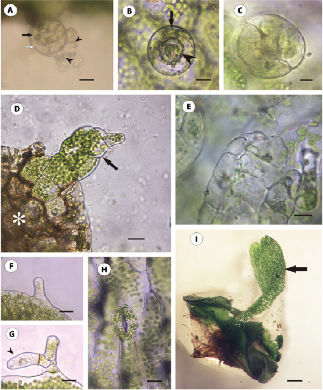 Gametangios y esporofito de M. mortoniana. (A) Anteridio, compuesto por una célula basal (flecha negra) y célula anular (flecha blanca) y anterozoides (cabeza de flecha). (B) Anteridio con su célula anular (flecha) y opérculo (cabeza de flecha). (C) Arquegonio con sus 4 hileras de células. (D) Yema en desarrollo (flecha) con tejido circundante del gametofito necrosado (asterisco). (E) Arquegonio, cada hilera con 5 células. (F) Pelo unicelular glandular del esporofito. (G) Pelo tricelular bifurcado del esporofito (cabeza de flecha). (H) Estoma anomocítico del esporofito. (I)Primera hoja del esporofito (flecha) y restos del gametofito. Escala de las barras: A: 15 µm; B: 10 µm; C: 5 µm; D: 30 µm; E: 5 µm; F: 15 µm; G-H: 20 µm; I: 250 µm.