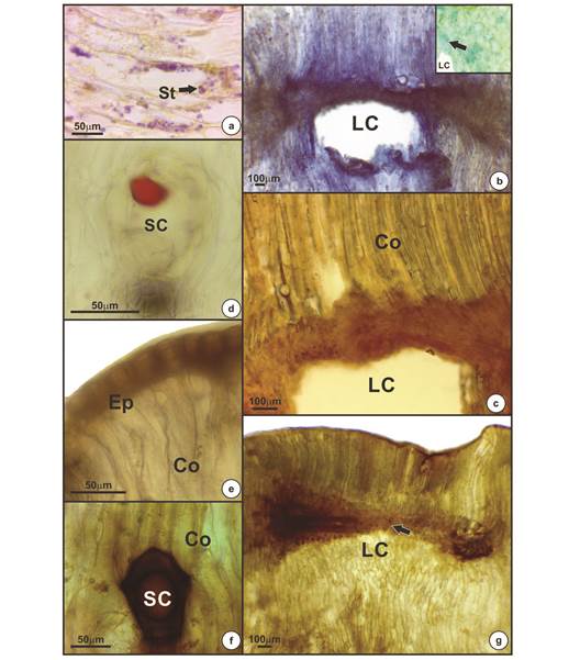 Positive histochemical results for mature galls of Eugenia uniflora induced by Eugeniamyia dispar. 
 a- Starch occurring near the larval chamber; b- proteins around the larval chamber; c- reducing sugar near the larval chamber; d- lipid compound detected in secretory cavity; e, f, g- oxidative stress occurs predominantly in the epidermis (e), secretory cavities (f) and in the vascular bundles near the larval chamber (g). Abbreviation: St- starch; LC- larval chamber; Co- cortex; SC- secretory cavity; Ep- epidermis.