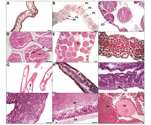 Holothuria mexicana. Light micrographs of female tubules illustrating the oogenic cycle. (A) Post-spawning; (B) Recovery stage showing nutritive phagocytes (Ph) inside residual oocytes; (C) Growth stage showing early oocytes (EO) in a rather empty lumen; (D) Advanced-growth stage showing abundance of mature oocytes with germinal vesicle (GV), nucleoli (N), follicular cells (FC) and Germinal Vessicle (GV) around nucleous; (E) and (F) Mature stage showing lumen filled with mature oocytes (M). Light micrographs of male gonad tubules illustrating the spermatogenic cycle. (G) Post-spawning testis showing empty lumen areas in the gonad tubules (L); (H) and (I) Growth stage showing the highly convoluted germinal epithelium (GE); (J) and (K) Mature stage showing the thin gonad tubule wall, reduced or absent proliferation zone (PZ), and great numbers of spermatozoa (SP) in the lumen; (L) Hermaphrodite showing a mature oocyte (M) surrounded by a large number of spermatozoa (SP). Black scale bar represents 100 &micro;m (A, B, E, G, H); grey scale bar represents 40 &micro;m (D, F, I, J, K) and white bar represents 500 &micro;m (C, L).