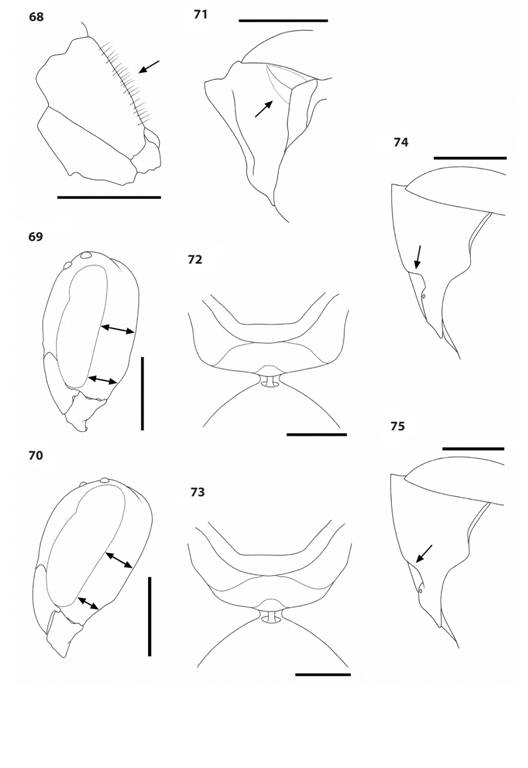 68. Metapolybia and Parachartergus species. 68. M. mesoamerica propodeum, lateral view, showing erect hairs (arrow). 69-70. Head, lateral view, showing dorsal and ventral width (arrows) of gena in M. mesoamerica (69) and M. aztecoides (70). 71. M. aztecoides, pronotum lateral view, showing protruding humerus (arrow). 72-73. Propodeum, posterodorsal view, showing quadrate posterolateral margins in P. fraternus (72) and rounded margins in P. apicalis (73). 74-75. Pronotum, lateral view, showing strongly curved carina (arrow) in P. apicalis (74) and weakly curved carina (arrow) in P. aztecus (75).