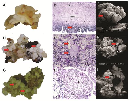 Macroscopic and microscopic comparison of initial, differentiation and maturation phases of somatic embryogenesis of Swietenia macrophylla. A. Cream-colored compact calli formed after six weeks of culture in induction medium, Bar: 1 cm. B. Parenchyma of immature cotyledons (*) and callus formation (arrow) during the initial phase. C. Callus seen from a Scanning Electron Microscope (SEM). D. Pre-embryogenic structures (arrows) protruding from the callus, Bar: 1 cm. E. Microphotograph of the maturation phase showing pre-embryogenic structures (arrows). F. Maturation phase showing somatic embryos (arrows) protruding from callus (*). G. Differentiation phase showing somatic embryos (arrows), Bar: 1 cm. H. Microphotograph of the maturation phase showing somatic embryos (*). I. Differentiation stage showing embryos (arrow) and callus (*). Bar: 1 cm.