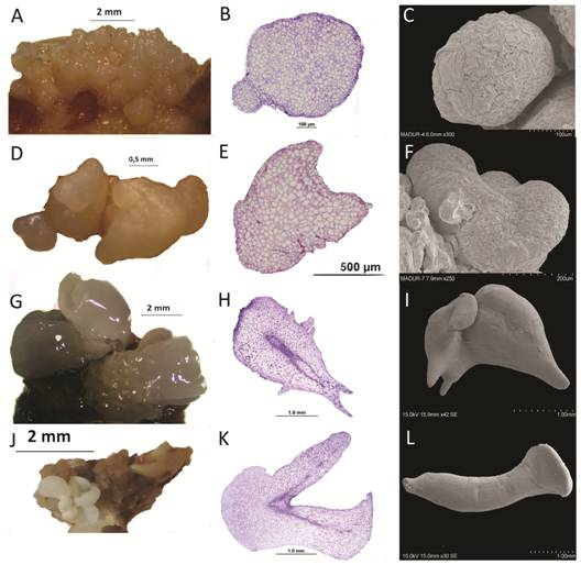 Developmental stages of somatic embryos of Swietenia macrophylla. A. Globular shaped somatic embryos (arrows) forming on the surface of embryogenic callus. B. Cross section of a globular somatic embryo with a suspensor-like structure (*). C. Scanning electron microscopy (SEM) image of globular embryo. D. Heart-shaped somatic embryo (arrow). E. Cross section of a heart-shaped embryo. F. SEM image of heart-shaped embryo. G. Torpedo-shaped somatic embryos (arrow). H. Cross section of a torpedo-shaped somatic embryo showing its initial procambium (*). I. SEM image of torpedo-shaped somatic embryo. J. Cotyledonary somatic embryo (arrow). K. Cross section of a cotyledonary embryo with its initial procambium (*). L. SEM image of cotyledonary somatic embryo.