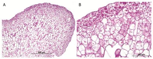 Starch grains in the parenchyma of globular somatic embryo of Swietenia macrophylla. A. Microphotograph at 100X. B. Microphotograph at 400X showing starch grains (arrows).