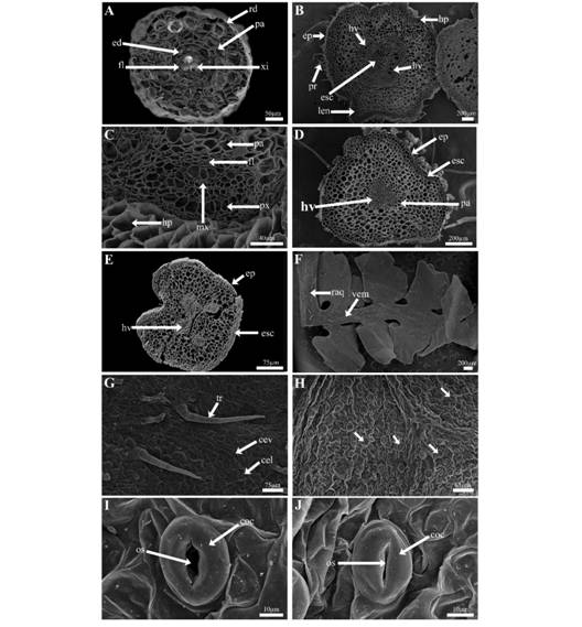 Anatom&iacute;a de la fase esporof&iacute;tica de P. aquilinum. A. Corte transversal de ra&iacute;z adventicia. B. Corte transversal de rizoma. C. Acercamiento a haz vascular del rizoma. D. Corte transversal de la base del peciolo. E. Corte transversal de raquis de primer orden. F. Pinna joven. G. Vista de la epidermis de la cara adaxial de la hoja. H. Vista de la epidermis de la cara abaxial de la hoja (flechas se&ntilde;alan a los estomas). I. Estoma anomoc&iacute;tico abierto. J. Estoma anomoc&iacute;tico cerrado. Cel = c&eacute;lulas epid&eacute;rmicas del limbo de la hoja, cev = c&eacute;lula epid&eacute;rmica asociadas al haz vascular, coc = c&eacute;lulas oclusivas, e = estomas, ed = endodermis, ep = epidermis, esc = escler&eacute;nquima, fl = floema, hp = hipodermis, hv = haz vascular, len = lenticela, mx = metaxilema, os = ostiolo, pa = par&eacute;nquima, px = protoxilema, tr = tricoma rz = rizodermis, vem = vena media y xi = xilema.
