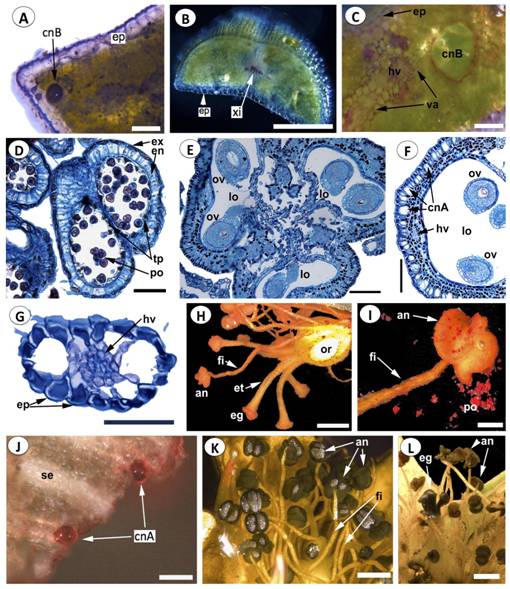 Histoqu&iacute;mica foliar y anatom&iacute;a e histoqu&iacute;mica floral de Hypericum juniperinum. A-C. Pruebas histoqu&iacute;micas en hoja; A. Sudan black; B. Fluoroglucinol; C. Rojo de rutenio; D. Secci&oacute;n transversal (ST) de antera; E. ST del gineceo trilocular; F. ST de la pared del ovario; G. ST del filamento del estambre; H-L. Pruebas histoqu&iacute;micas en flor; H. Sudan III en gineceo; I. Sudan III en anteras; J. Sudan III, positivo para los canales del s&eacute;palo; K. Sudan black en anteras; L. Prueba de cloruro f&eacute;rrico. An = antera, CnA = canales tipo A, cnB = canales tipo B, ep = epidermis, en = endotecio, ex = exotecio, eg = estigma, et = estilo, fi = filamento, hv = haz vascular, lo = l&oacute;culo, or = ovario, ov = &oacute;vulo, po = polen, se = s&eacute;palo, tp = tapetum, va = vaina haz vascular, xi = xilema. A-C., H-L. Estereomicroscopio; D-G. Microscopio &oacute;ptico, tinci&oacute;n con astra blue-Fucsina b&aacute;sica. Escalas: 1 mm en H, K-L., 500 μm en B., 200 μm en I., 100 μm en A, C, E, F, J., 50 μm en D, G. Figuras a color en la versi&oacute;n digital.