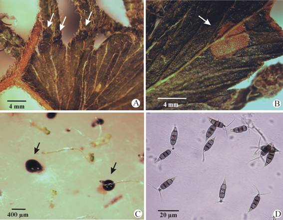 Evidences of Pestalotiopsis maculans in sporophyte and spore cultures of Lygodium venustum. (A) Leaf with dark pustules (conidiomata) (arrows) close to the fertile leaf portion. (B) Necrotic spot on the leaf (arrow). (C) Cirri differentiated in non-disinfected spore cultures (arrows). (D) Conidia of P. maculans.