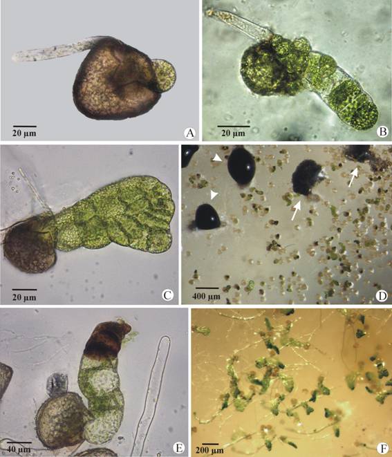 Development of Lygodium venustum gametophytes in unsterilized spore cultures. (A) Germinated spore showing the hyaline rhizoid and the protonemal initial. (B) Early filamentous phase of the gametophyte. (C) Spatulate gametophyte. (D) Cirri differentiation (arrowheads) and release of conidia (arrows) among the gametophytes. (E) About 7 days-old gametophytes with signs of necrosis. (F) Long filamentous and spatulate gametophytes growing among fungal hyphae.