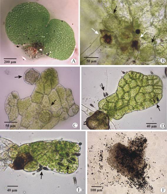 Development of Lygodium venustum gametophytes in sterilized and reinoculated cultures. (A-C) Gametophytes developed in disinfected cultures. (A) Cordiform bisexual gametophyte. (B) Detail of antheridia (black arrows) and archegonia (white arrows). (C) Spatulate male gametophyte (arrows points to antheridia). (D-F) Gametophytes from reinoculated cultures. (D) Spatulate healthy gametophyte with conidia of P. maculans on its surface (arrows). (E) First symptoms of gametophyte necrosis associated with the presence of conidia (arrows). (F) Completely necrotic gametophyte covered by a lot of conidia.