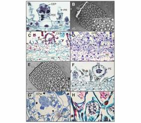 Phymatosorus scolopendria. Ontogenia de los esporangios y par&aacute;fisis receptaculares. A. Esporangios y par&aacute;fisis receptaculares indiferenciadas (Hematoxilina-azul de alciano). B. Acercamiento al soro inmaduro; en el recuadro se observan los primordios de los esporangios y las par&aacute;fisis (Microscop&iacute;a electr&oacute;nica de barrido-MEB). C. Los pedicelos, las c&aacute;psulas de los esporangios y par&aacute;fisis han experimentado divisiones mit&oacute;ticas. Los esporocitos premei&oacute;ticos se han diferenciado y se aprecian rodeados por una capa de c&eacute;lulas parietales; las par&aacute;fisis se observan pluricelulares (Safranina-azul de alciano-FASGA). D. Secci&oacute;n longitudinal del soro, el tapete celular uniestratificado se ha diferenciado. Note los dep&oacute;sitos de polifenoles (Toluidina). E. Detalle morfol&oacute;gico de D., en el recuadro las par&aacute;fisis maduras se curvan hacia los esporangios (MEB). F-G. Diferenciaci&oacute;n del tapete celular biestratificado (Hematoxilina-azul de alciano y Toluidina, respectivamente). H. T&eacute;trada de esporas con tapete plasmodial persistente (FASGA). CEP: c&aacute;psula del esporangio; EPM: esporocitos premei&oacute;ticos; EP: esporangios; PE: pared de los esporangios; PEE: pedicelos de los esporangios; PF: polifenoles; PR: par&aacute;fisis receptaculares; RE: recept&aacute;culo; SO: soro; TB: tapete celular biestratificado TI: t&eacute;trada inmadura; TP: tapete plasmodial; TU: tapete celular uniestratificado.